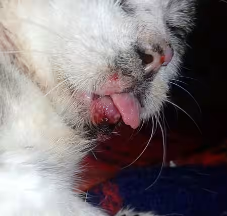 Direkt an Grindelwalds Unterlippe bildete sich ein sogenanntes Fibrosarkom